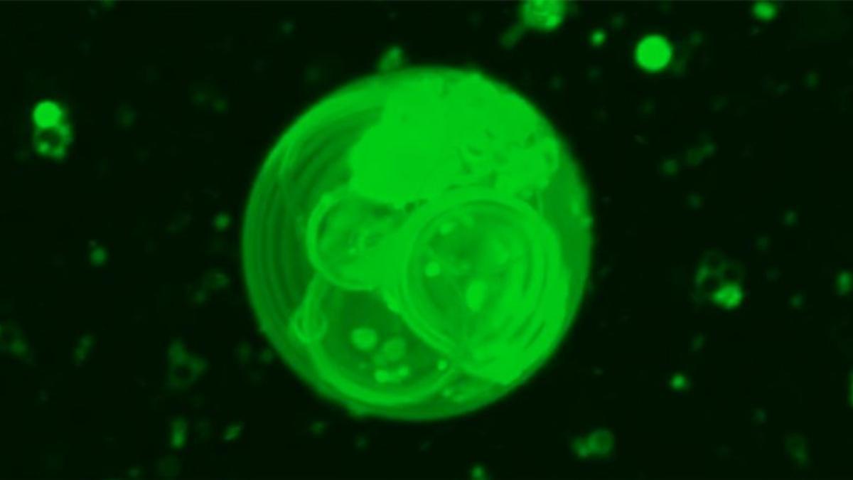 Vesículas dentro de una estructura similar a una protocélula.