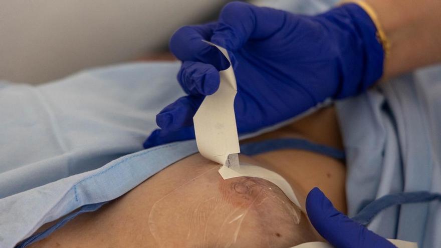 El Hospital de Elda atiende a 200 pacientes para realizarles micropigmentación areolar