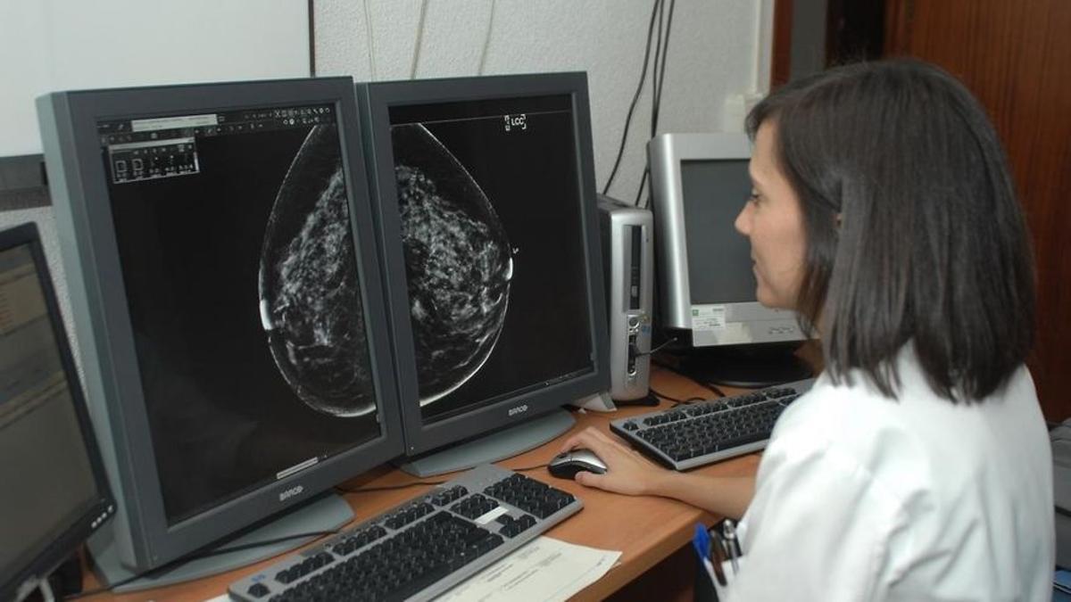 La mamografía con contraste es una técnica novedosa similar a la mamografía convencional que se realiza con contraste yodado intravenoso