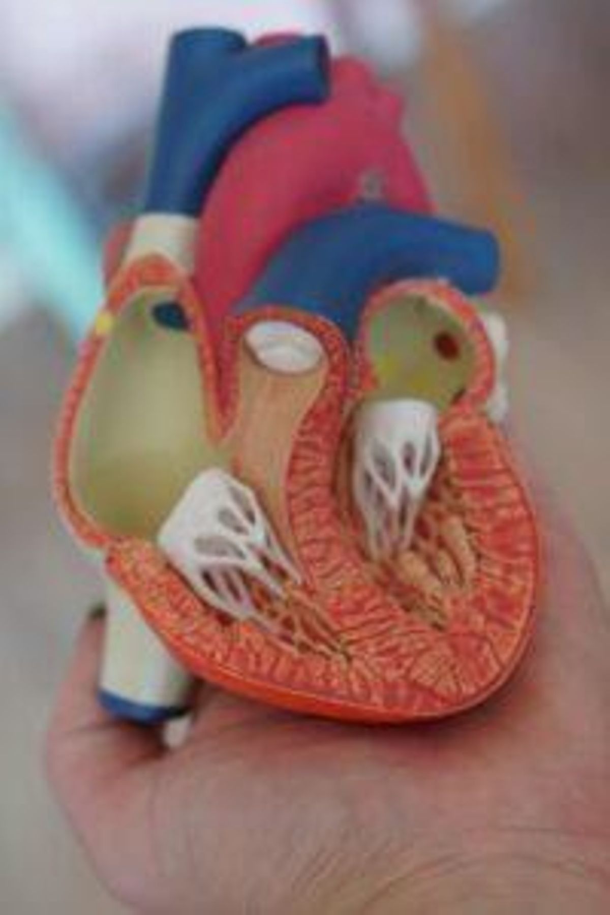 ¿Qué es un aneurisma de aorta abdominal? ¿Se puede tratar?