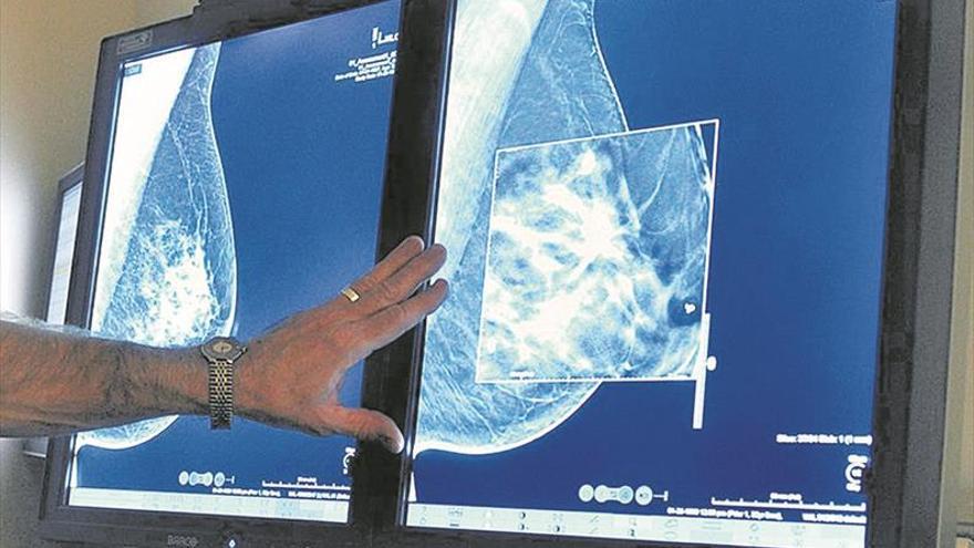 El 70% del cáncer de mama más común no precisará quimioterapia