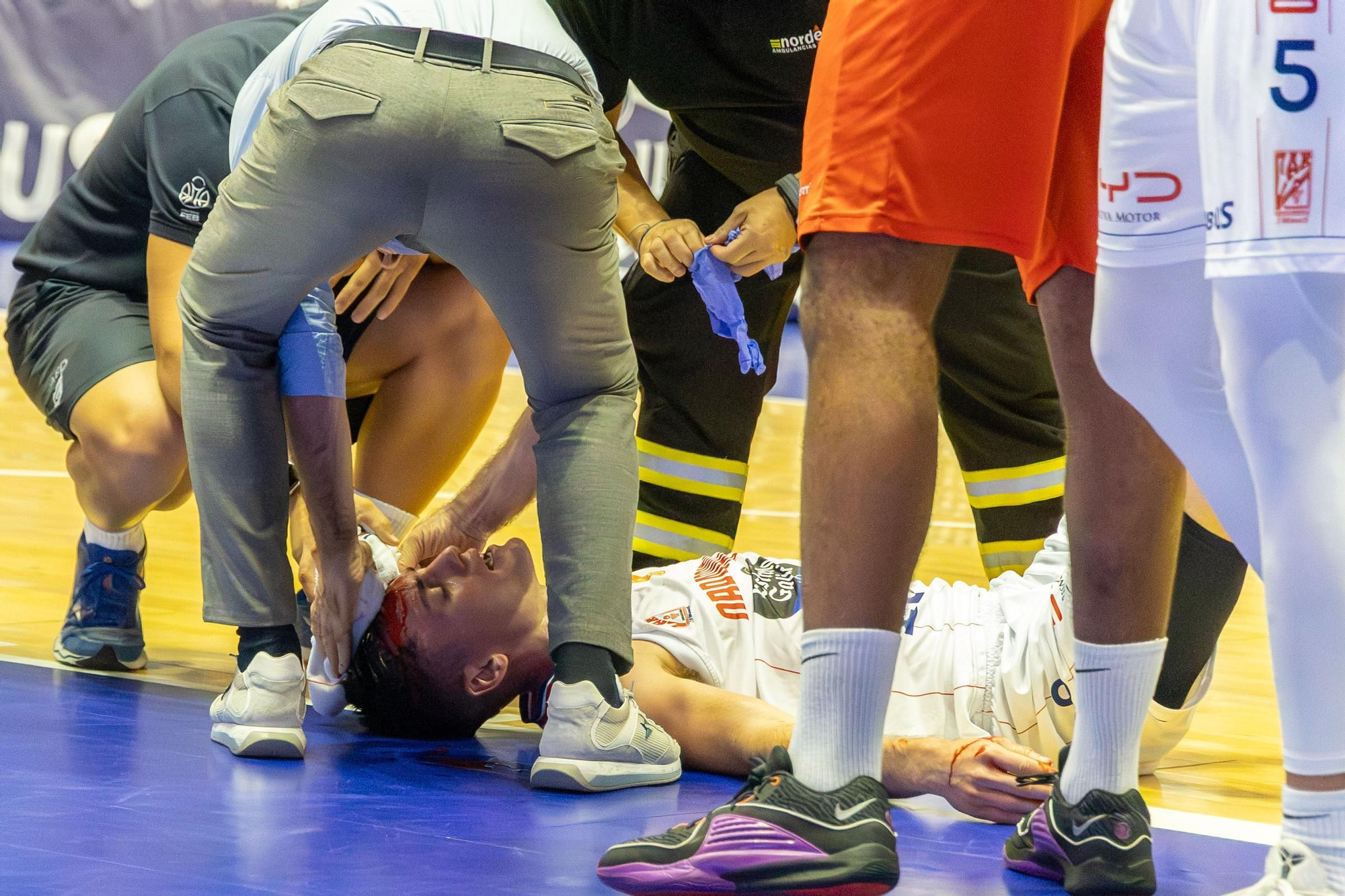El Obradoiro se lleva su torneo con sangre, sudor y lágrimas