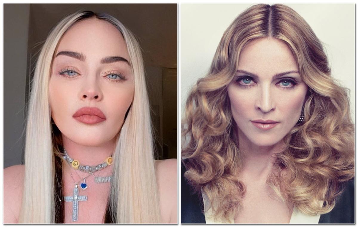 Así ha cambiado el rostro de Madonna tras su nueva operación estética. Así ha cambiado el rostro de Madonna tras su nueva operación estética.