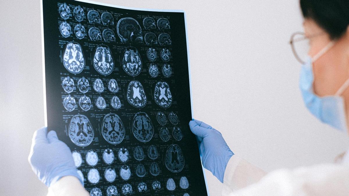 Un profesional de la salud mira las imáganes de un cerebro en un TAC.