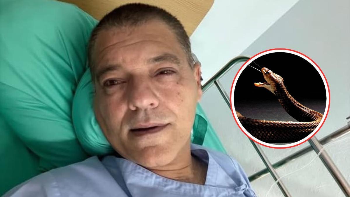 Frank Cuesta en un hospital tras estar en contacto con el veneno de una cobra escupidora.