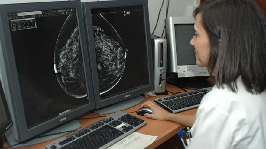 Revisión de una mamografía