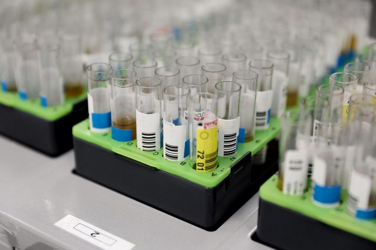 Probetas de pruebas PCR en el Laboratorio de Microbiología del Hospital público Gregorio Marañón.