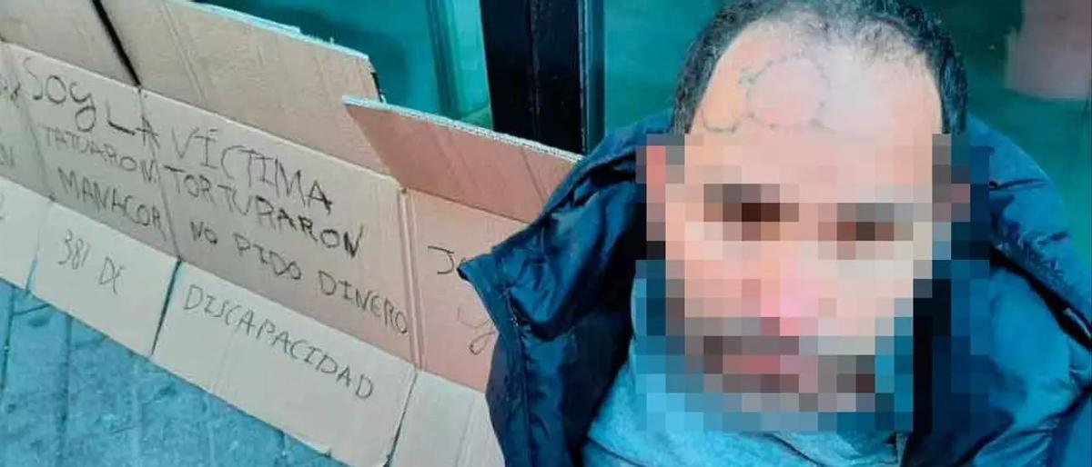 Das mutmaßliche Opfer. Auf der Stirn sind die Tattoos zu sehen.