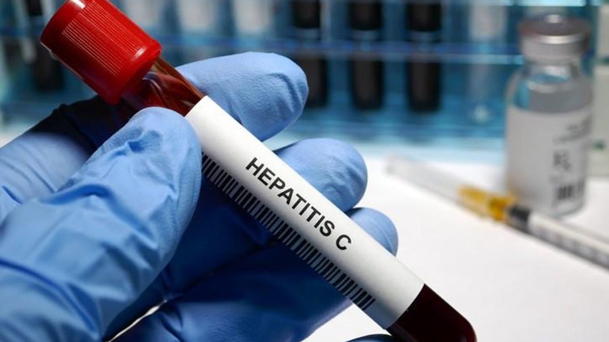 Imagen de archivo de una prueba de hepatitis C.