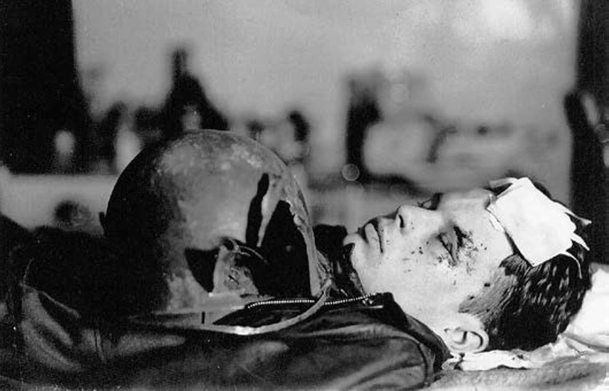 Un joven piloto estadounidense herido en la cabeza por un proyectil alemán.