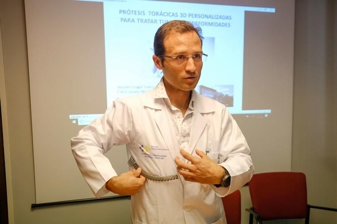 Las Palmas de Gran Canaria . Presentación de resultados del sistema de prótesis torácicas 3D.  | 05/02/2020 | Fotógrafo: José Carlos Guerra