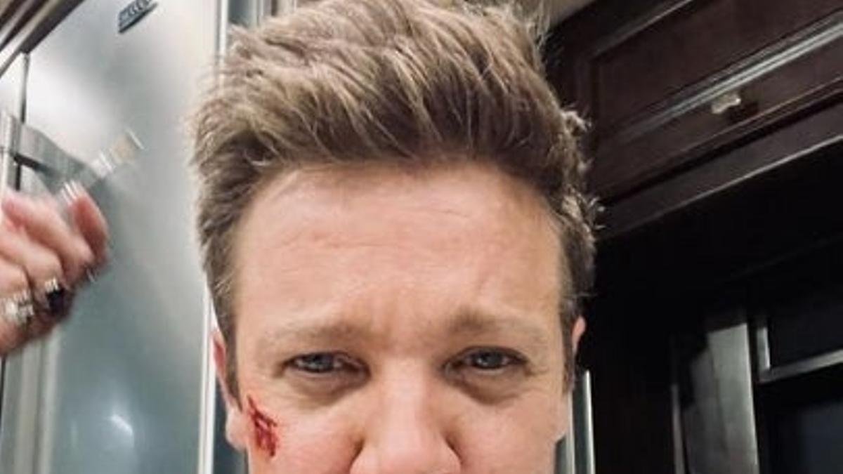 Jeremy Renner enseña las heridas tras su accidente 'quitanieves' y... Pobre