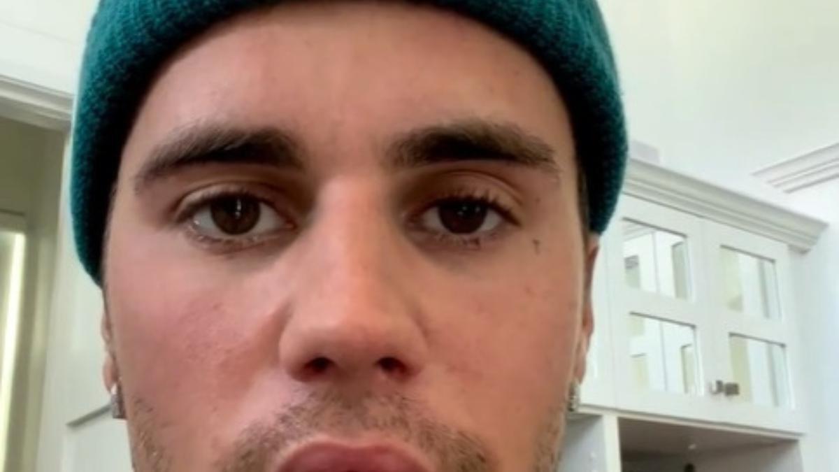 El síndrome de Ramsay Hunt: así es el virus de Justin Bieber que le ha provocado una parálisis facial