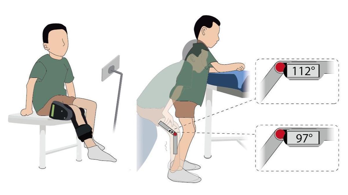 Ilustración del dispositivo desarrollado para ayudar a la recuperación de los niños con atrofia muscular espinal