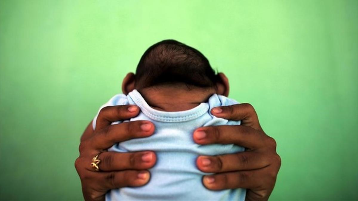 Una madre sostiene a su bebé de cuatro meses, afectado de microcefalia, en Brasil.