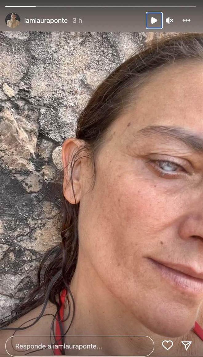 Laura Ponte posa con su ojo sin visión en Instagram