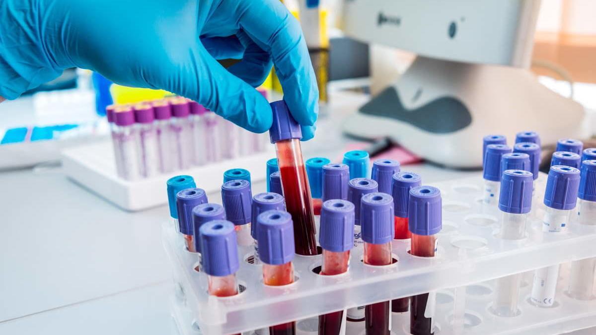 Detectan el cáncer con un análisis de sangre.