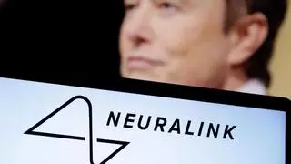 Musk afirma que su empresa de chips cerebrales, Neuralink, ha realizado el segundo implante en un paciente