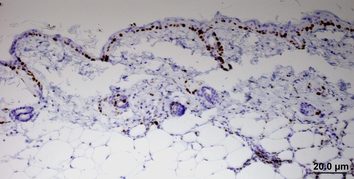 Archivo - Investigadores del CNIO descubren una de las estrategias del cáncer para escapar de la quimioterapia.