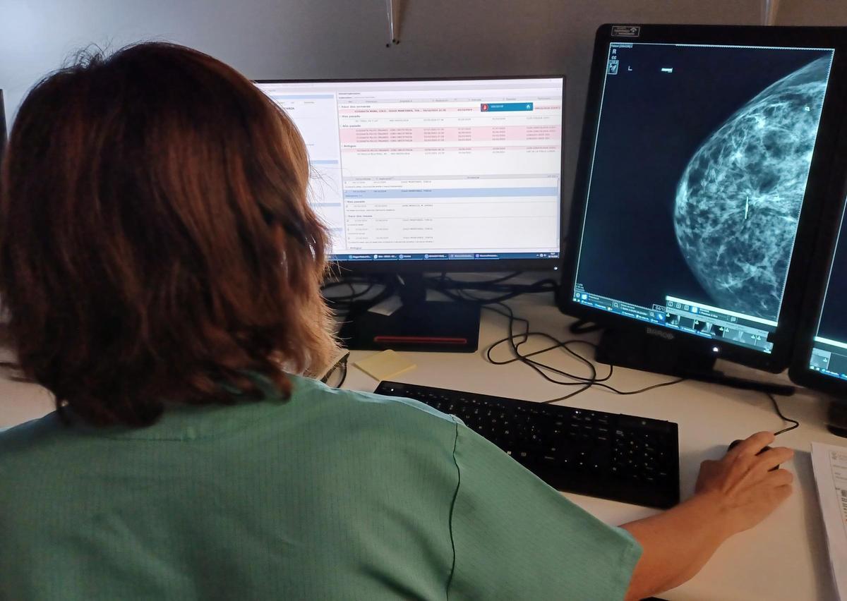 Una radióloga observa imágenes en la sala de informes radiológicos.