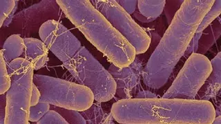 Helicobacter pylori: así son los síntomas de la infección que afecta a la mitad de la población