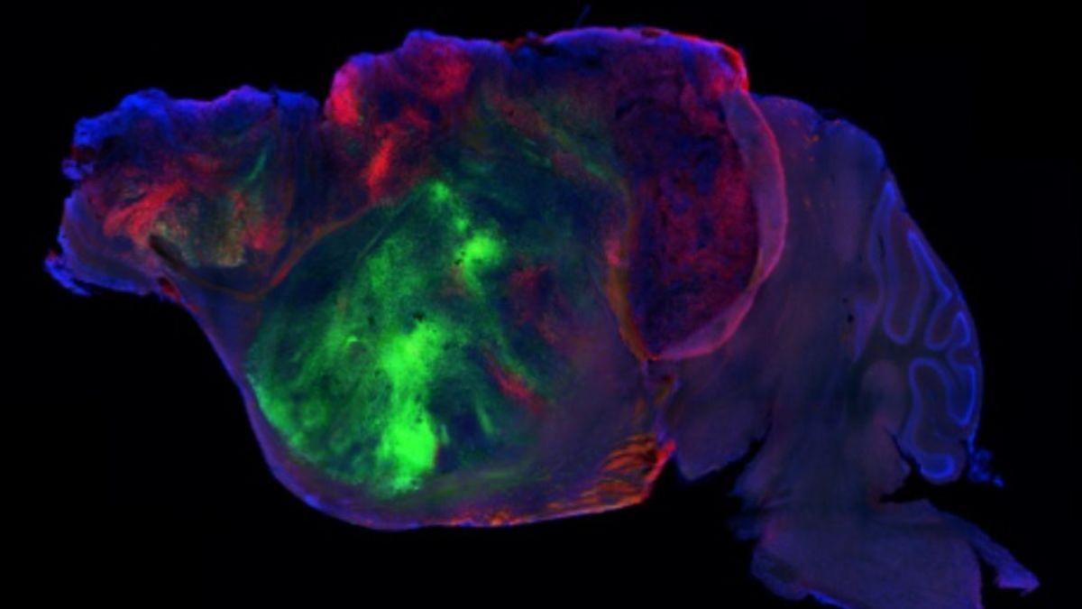 Crean ratones con cerebros formados por neuronas humanas