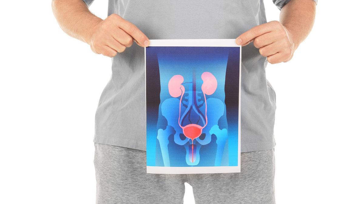 Un hombre sostiene una ilustración donde se aprecia una próstata, entre otros órganos