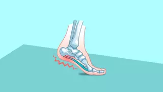 Desde fascitis plantar hasta dolores de espalda: estos son los riesgos de “vivir” en chanclas en verano