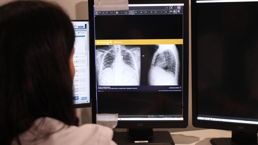 La Inteligencia Artificial llega a la sanidad asturiana: el hospital de Mieres, pionero en usarla para el análisis de radiografías