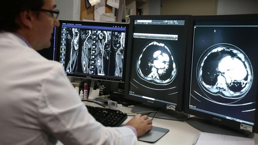 El Sergas encarga a expertos buscar nuevos usos de la inteligencia artificial en sanidad
