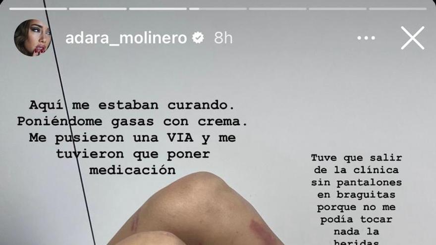 Adara Molinero denuncia lo ocurrido en redes sociales.