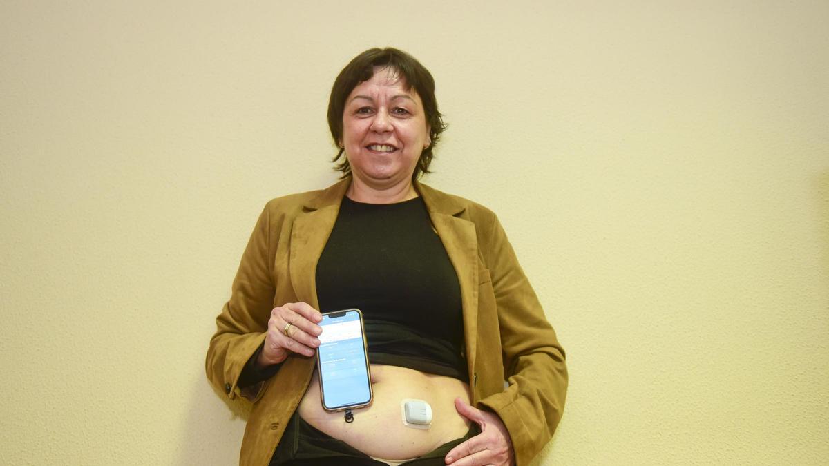 María José Neira, coruñesa con diabetes tipo 1, muestra su nanobomba de insulina y la aplicación móvil para su manejo.