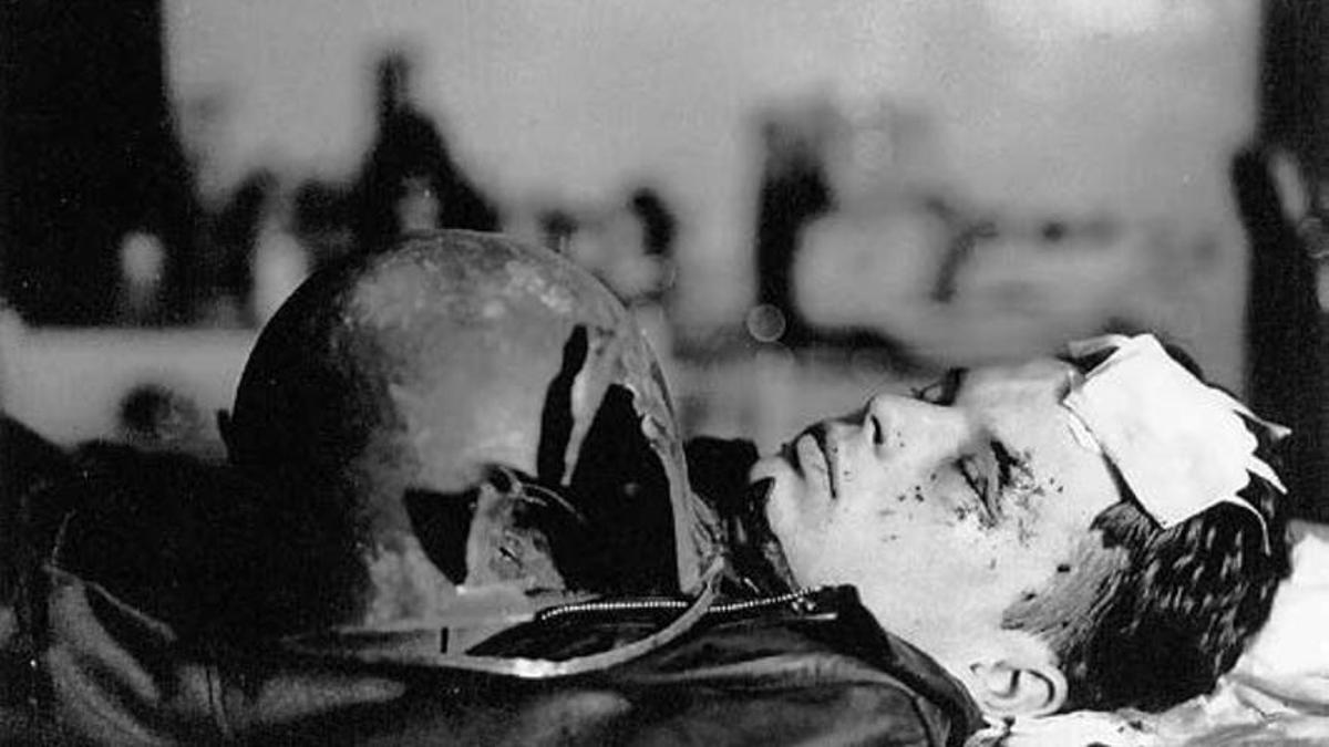 Un joven piloto estadounidense herido en la cabeza por un proyectil alemán.