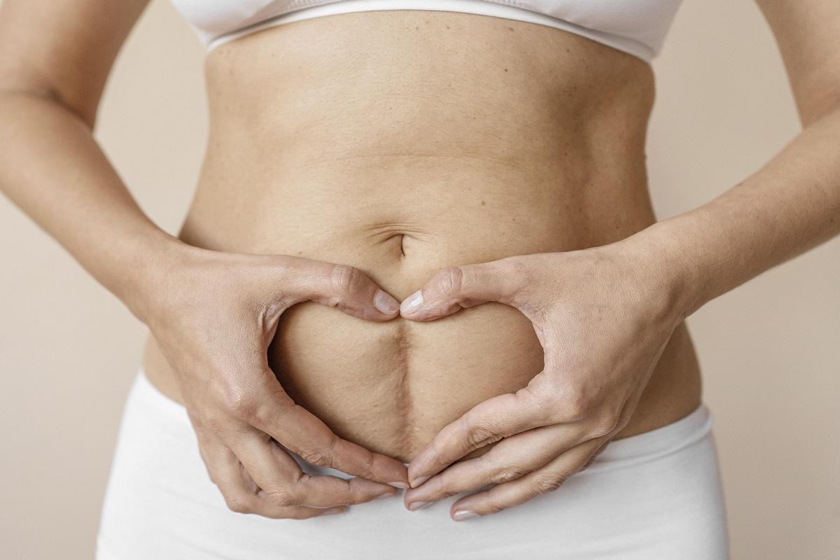 ¿Qué es la diástasis abdominal y cómo se puede corregir?