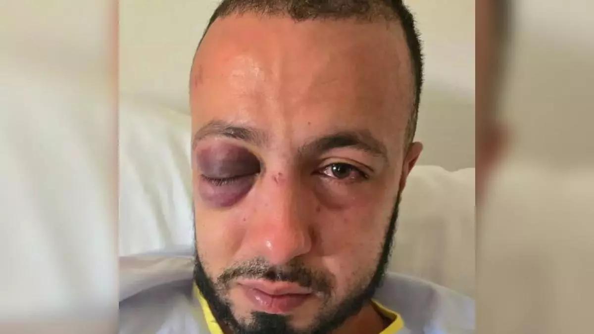 Imagen de uno de los agredidos en el hospital.