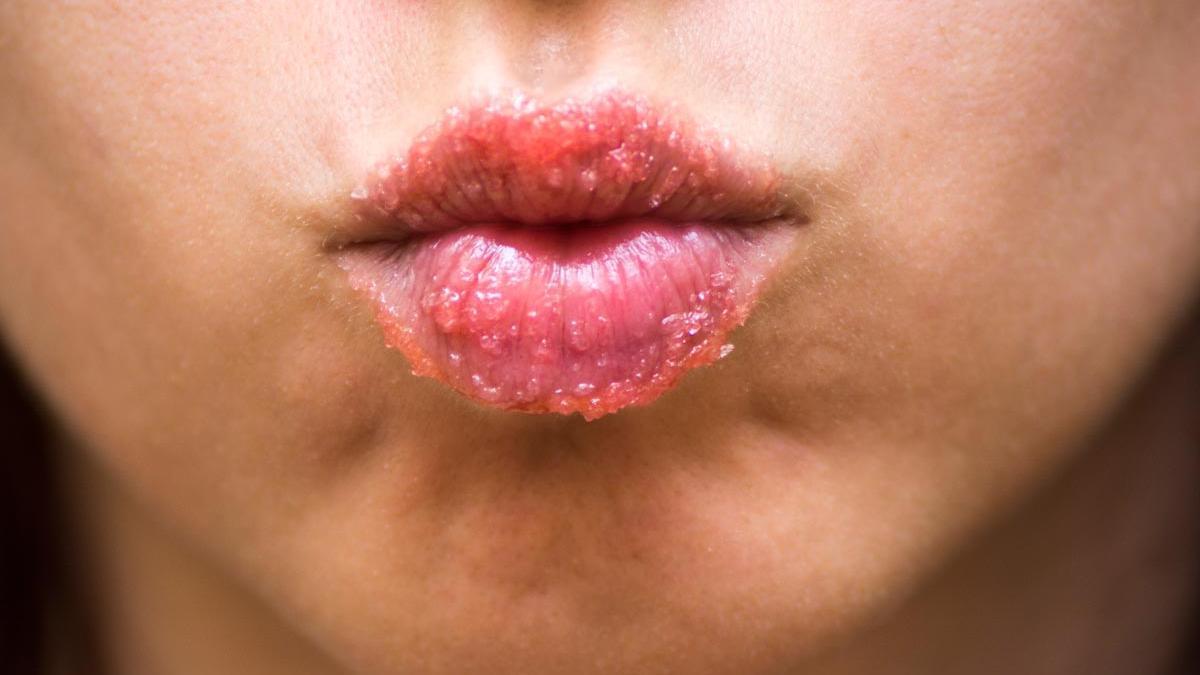 Exfoliar o no los labios, esa es una cuestión