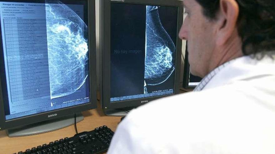 Un médico observa una mamografía en el ordenador. // Faro