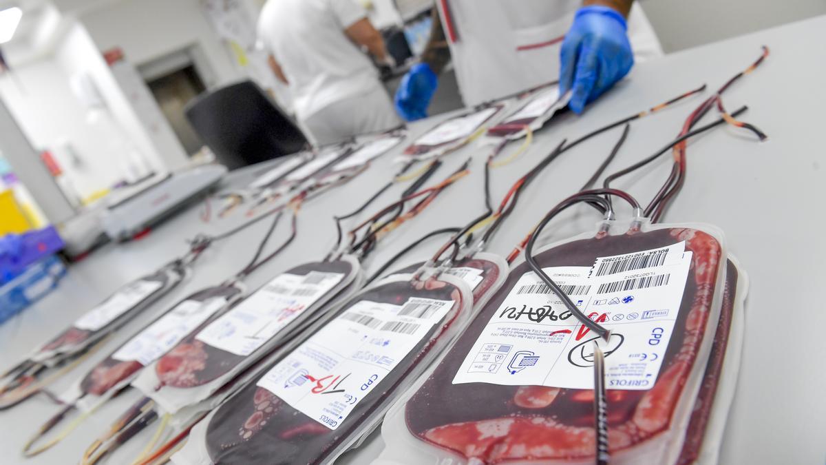 Muestras de sangre en el laboratorio del ICHH de la capital grancanaria.