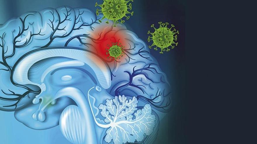 El zika combate los tumores cerebrales