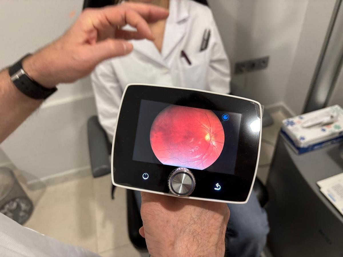 Imatge que genera el retinògraf