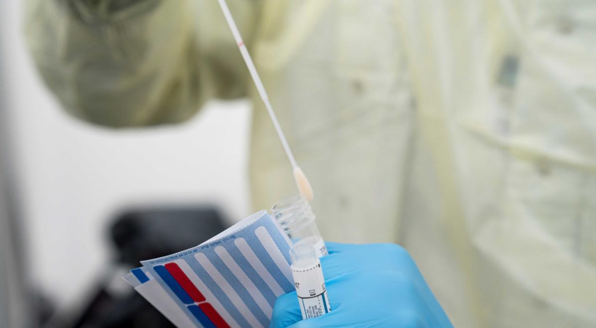 Los nuevos test rápidos que compró el Gobierno dan falsos negativos si el contagio es reciente