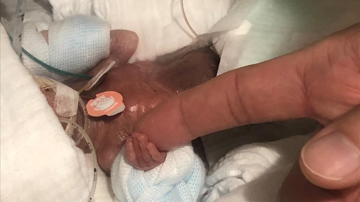 zentauroepp47146974 a baby boy weighing 268 grams when born in august 2018 the 190227121006 zentauroepp47146974 a baby boy weighing 268 grams when born in august 2018 the 190227121006