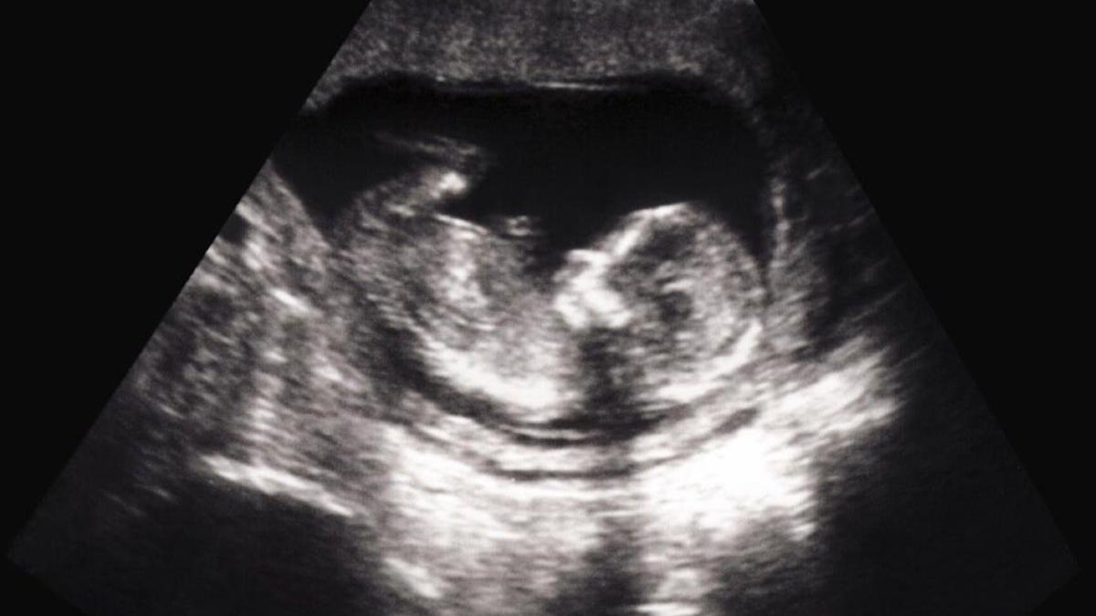 Eslovaquia quiere obligar a las mujeres que aborten a ver antes el embrión