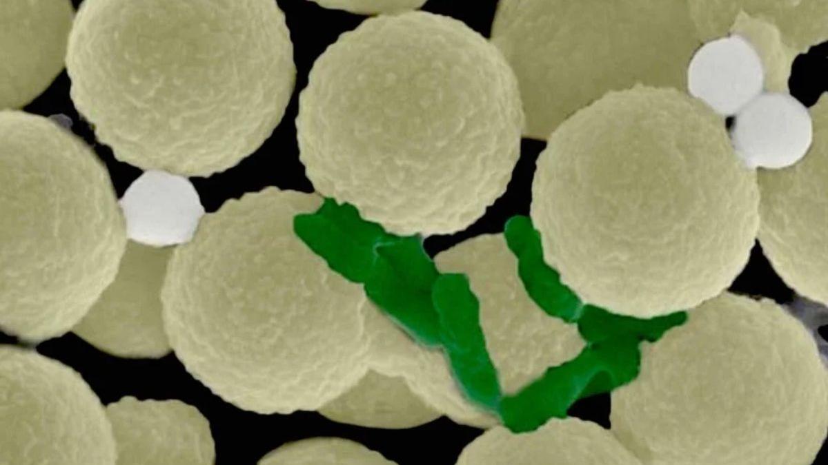 Los pequeños robots esféricos (amarillo claro) recolectan bacterias (verde) y pequeños trozos de plástico (gris) del agua, mientras se encuentran bajo la influencia de un campo magnético giratorio.