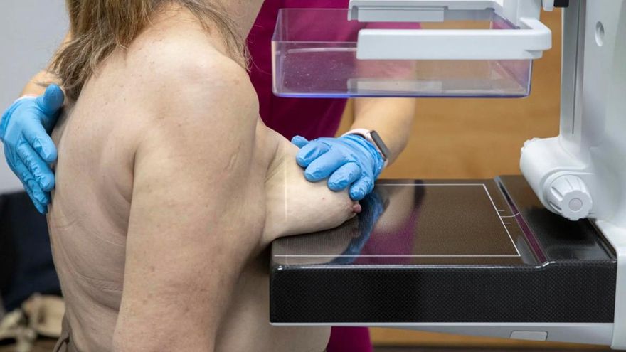 Sofocos, insomnio y deshidratación: el verano complica el día a día de las mujeres con cáncer de mama en tratamiento