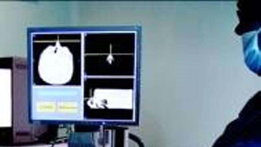 Otorrinos de Cáceres utilizan un navegador en cirugía nasal