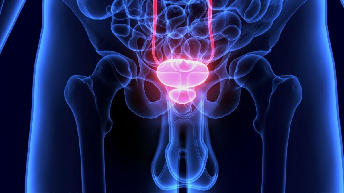 Inteligencia Artificial contra el cáncer de próstata