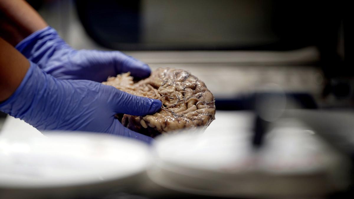 Imágenes del banco de cerebros de la Fundación CIEN.