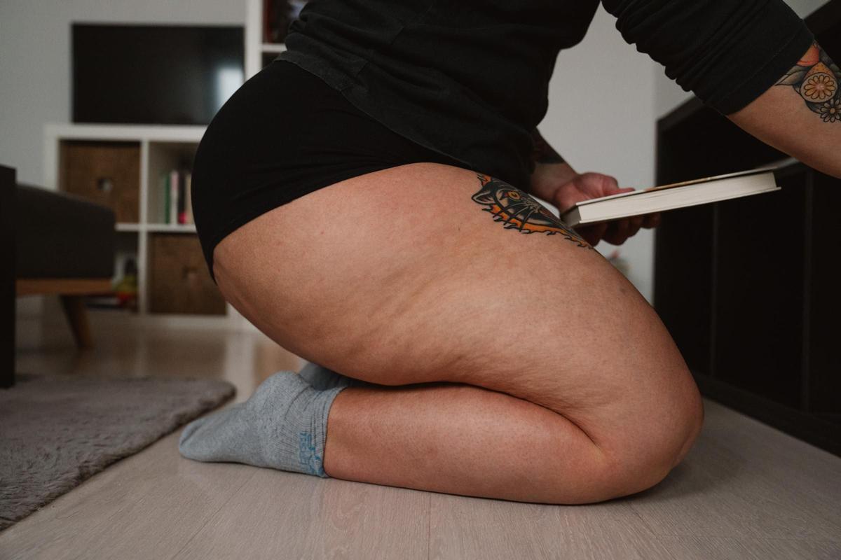 Imagen de las piernas de Ana Ayuso, paciente de lipedema, en su casa de Madrid.