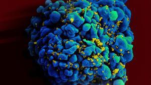 Escaneo electromicrográfico de una célula T infectada por VIH.